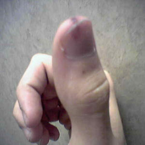 Thumb-smashing fun for the whole family!