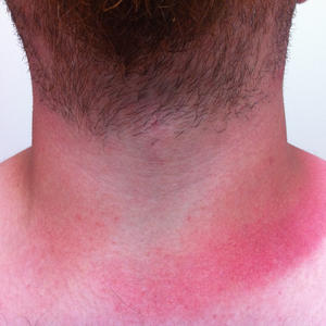 Winner of the 2011 Uneven Burn Award.