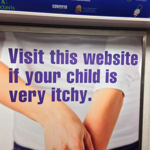 What if they are only marginally itchy?